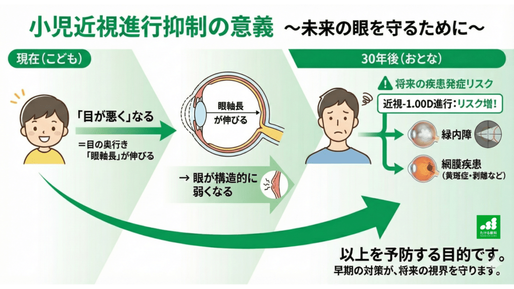 小児近視進行抑制の意義