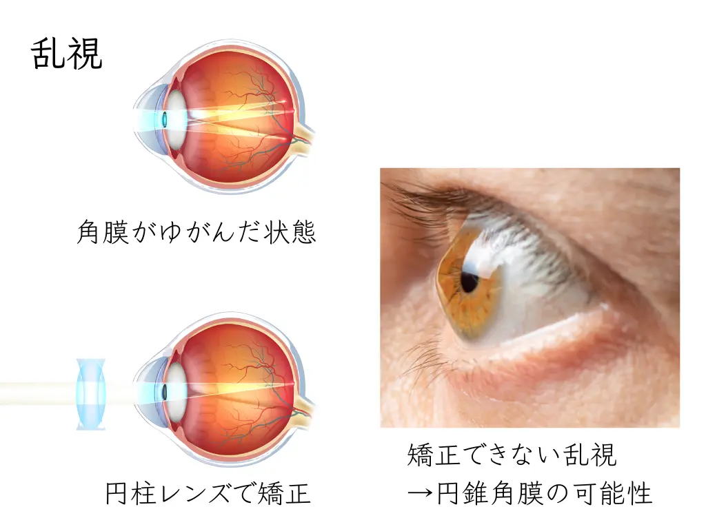 画像に alt 属性が指定されていません。ファイル名: %E4%B9%B1%E8%A6%96.webp