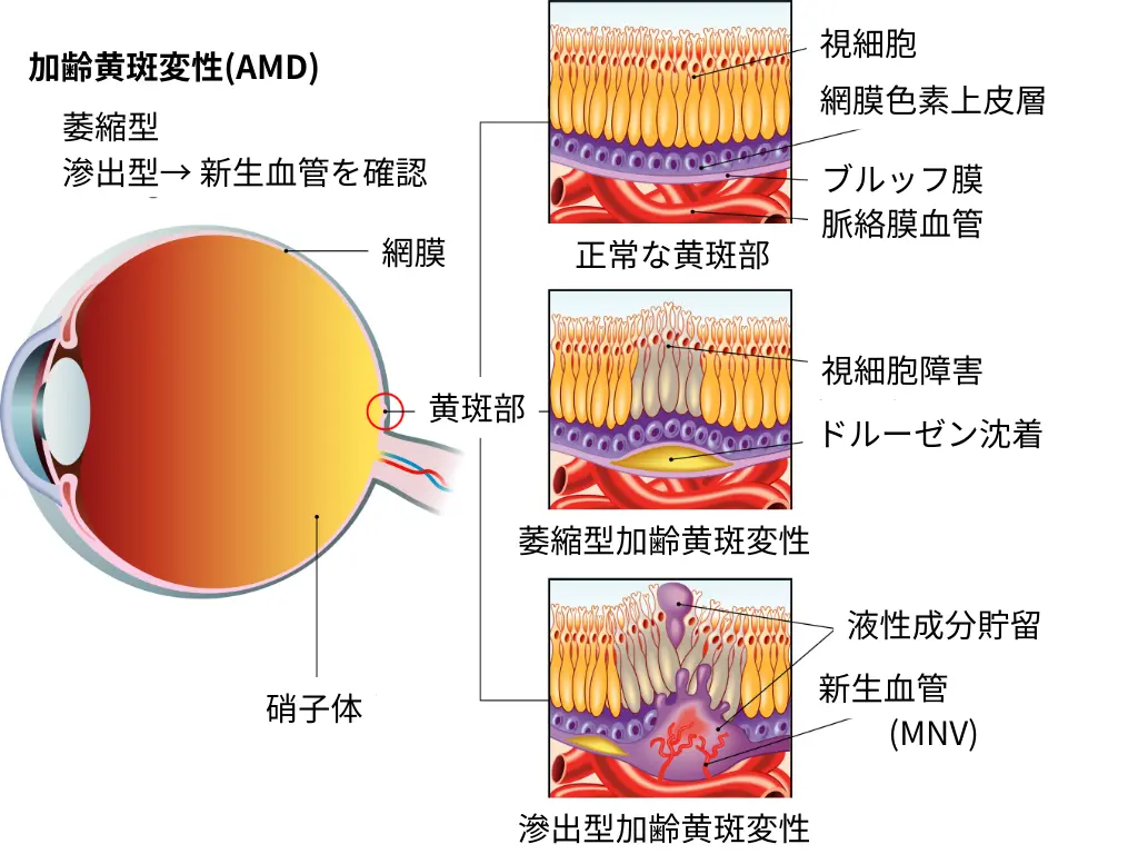 目の状態を総合的に評価する「眼科ドック」：新しく整備しました。 | たける眼科 | 福岡市早良区 高取商店街［西新駅／藤崎駅］