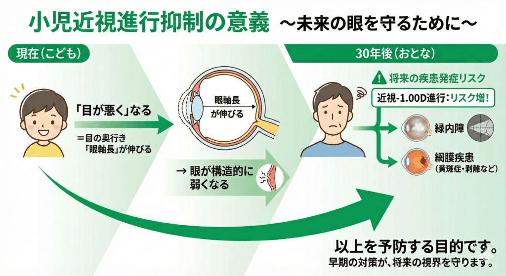 小児近視進行抑制の意義