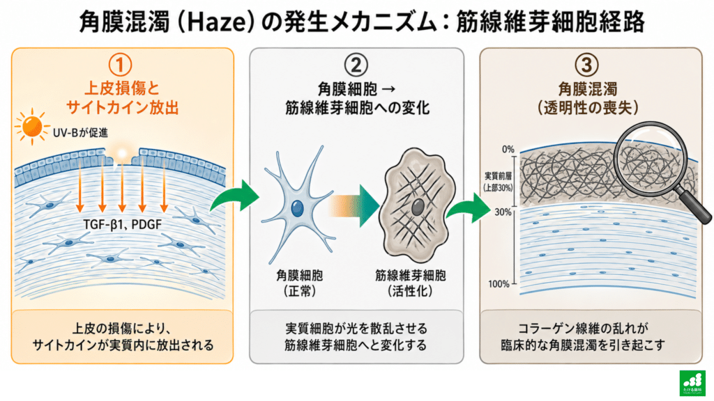 LASIK後の遅発性角膜混濁：数年後に起こりうる眼の変化と対処 | たける