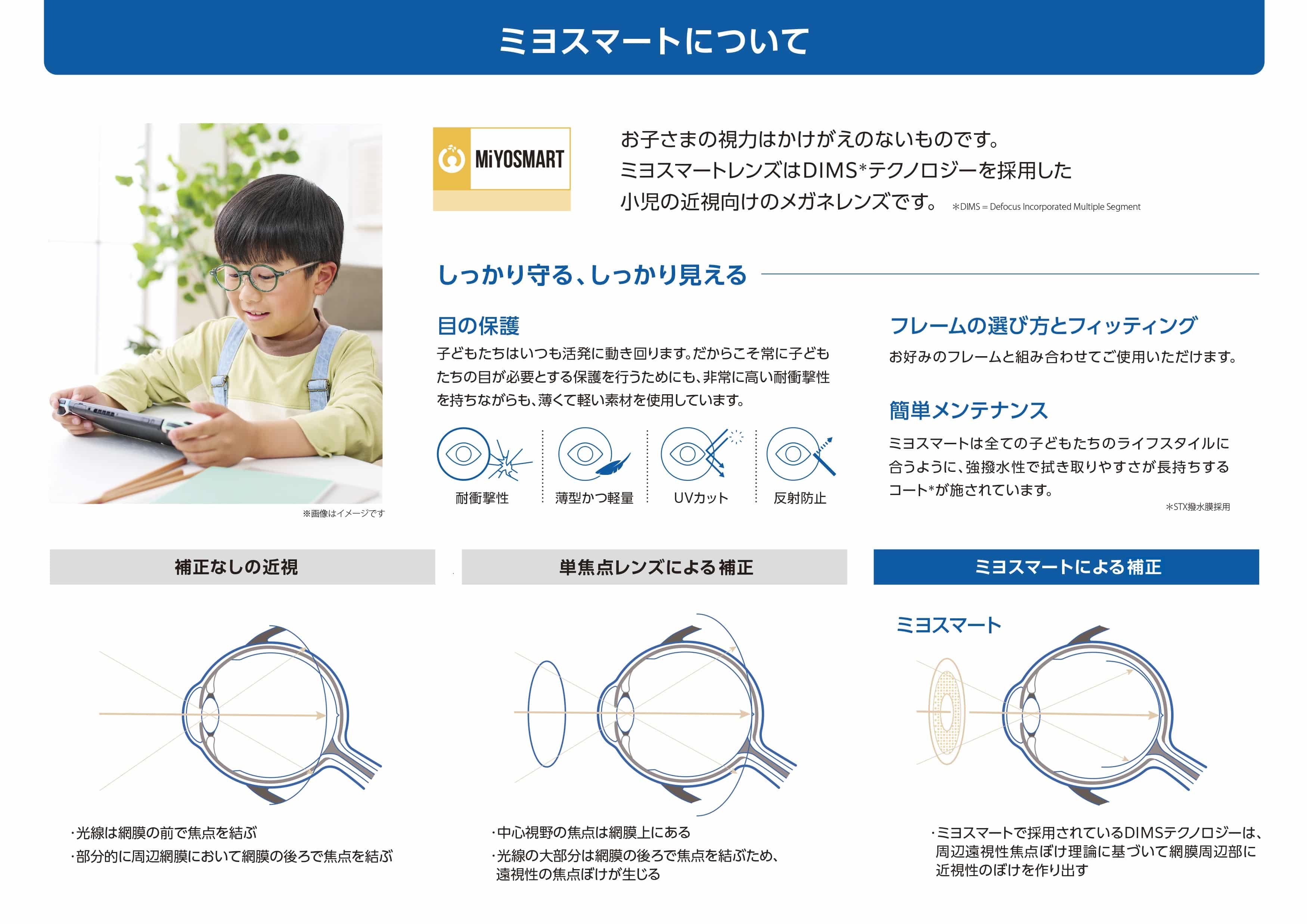 近視抑制メガネ MiYOSMART(ミヨスマート)