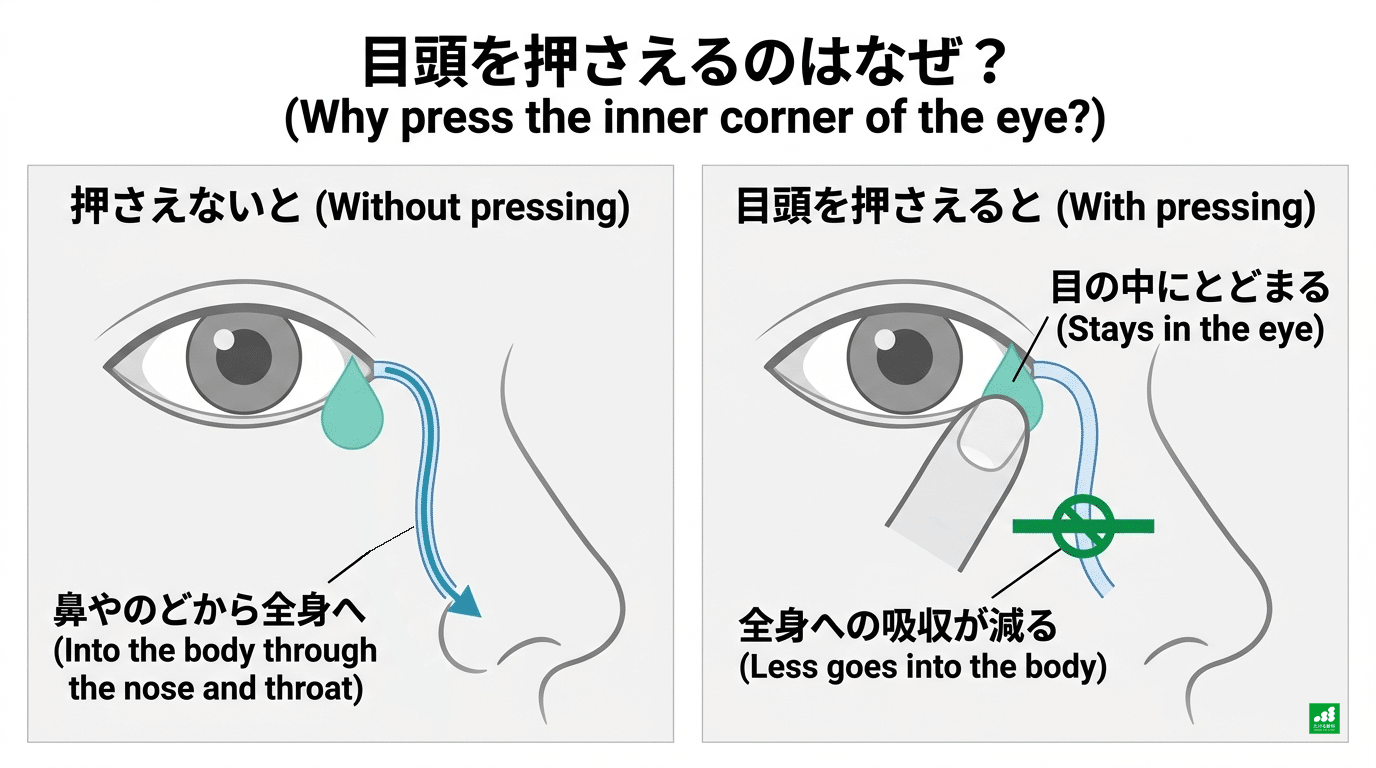 目頭を押さえる理由を示した模式図。押さえないと薬が涙の通り道から鼻やのどへ流れて全身に吸収される。目頭を押さえると薬が目の中にとどまり、全身への吸収が減る