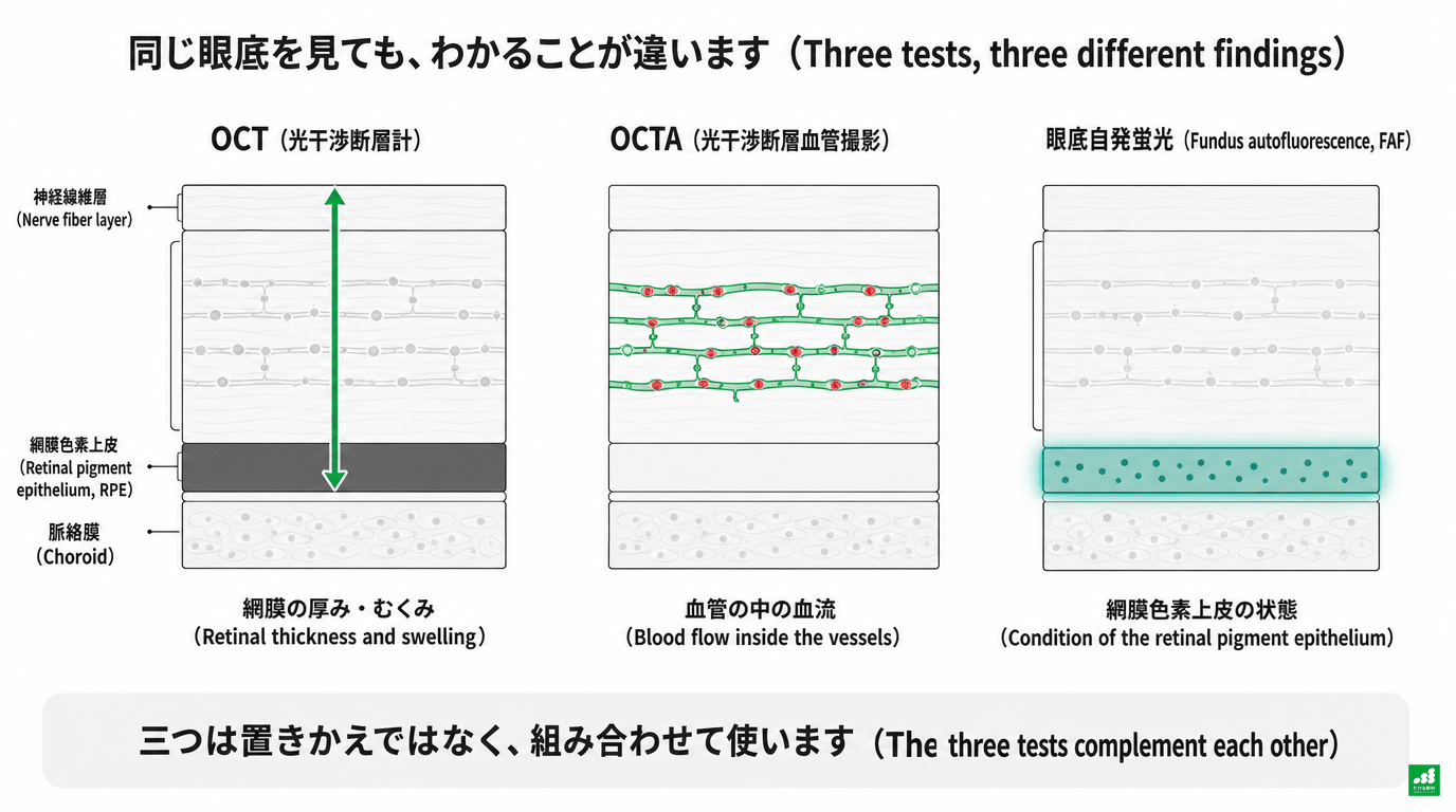 OCT・OCTA・眼底自発蛍光(FAF)の違いを、同じ網膜の断面で比べた図:OCTは網膜の厚み・むくみ、OCTAは血管の中の血流、FAFは網膜色素上皮の状態を見る。三つは置きかえではなく、組み合わせて使う